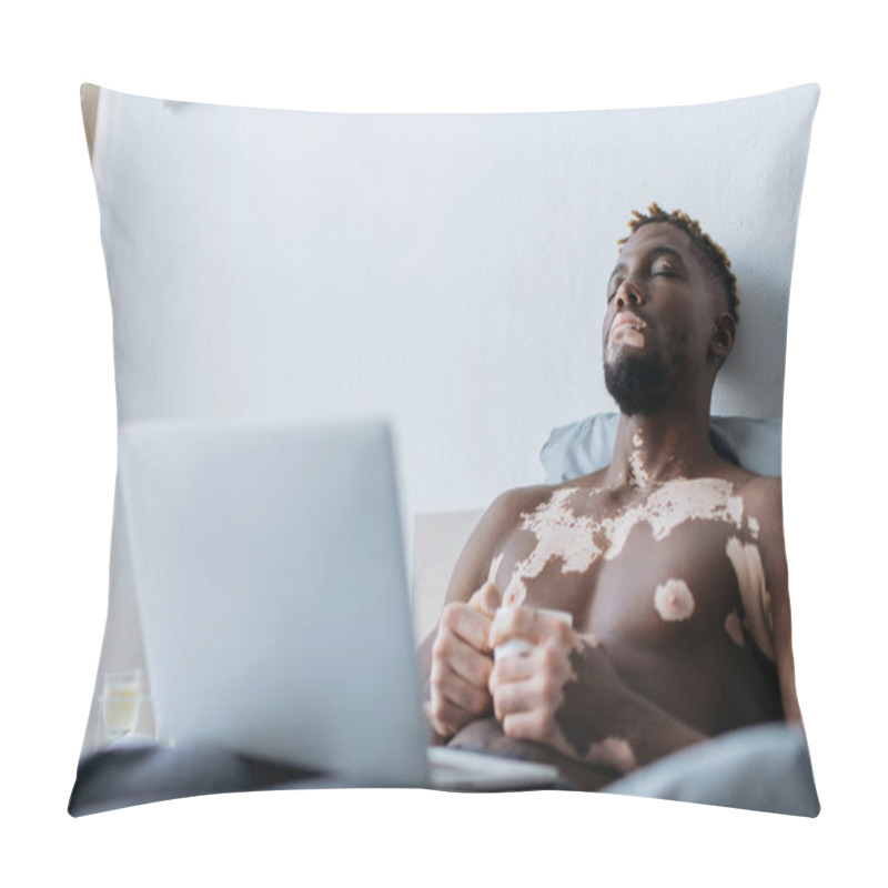 Personality  Tired African American Man With Vitiligo Holding Coffee Near Laptop On Bed  Pillow Covers