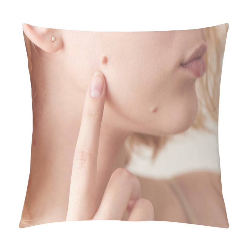 Personality  Mole On The Young Girl's Face Skin Closeup Pillow Covers