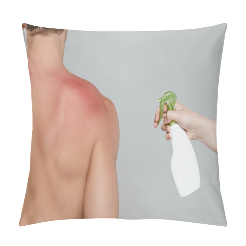 Personality  Cropped View Of Woman Applying Spray On Male Back With Redness Isolated On Grey Pillow Covers