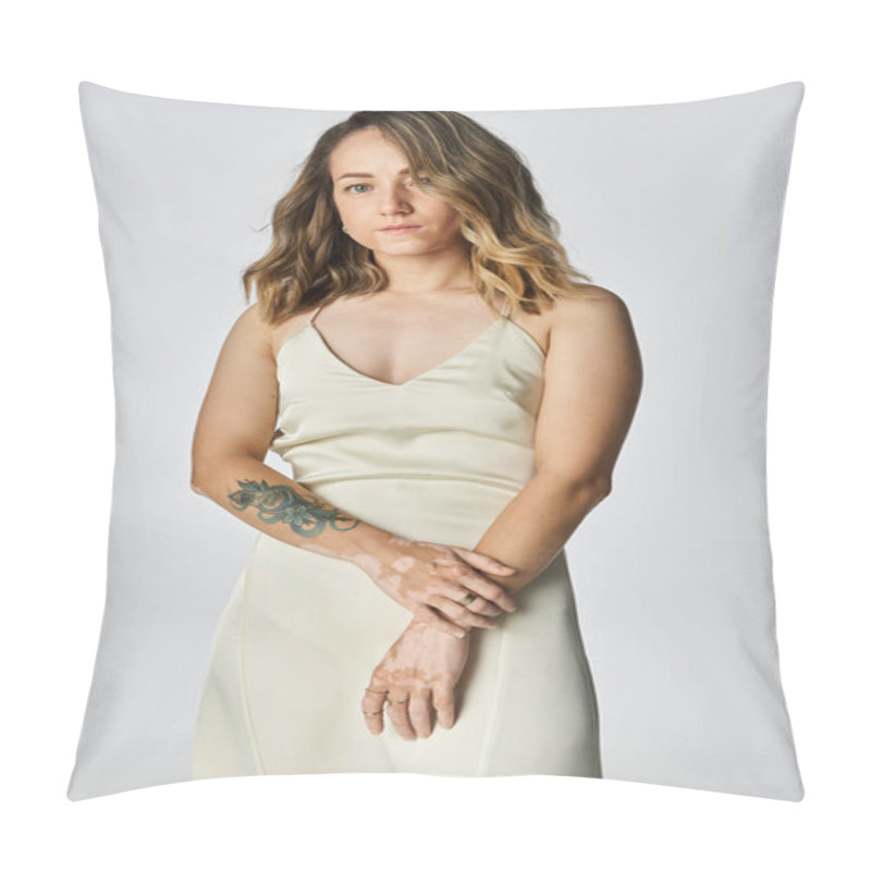 Personality  A Beautiful Young Woman With Vitiligo Stands Confidently, Showcasing Her Uniqueness And Style. Pillow Covers