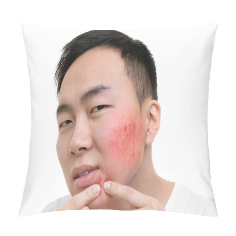 Personality  Skin Care Concept. Young Man Squeezing Pimple, White Background Pillow Covers