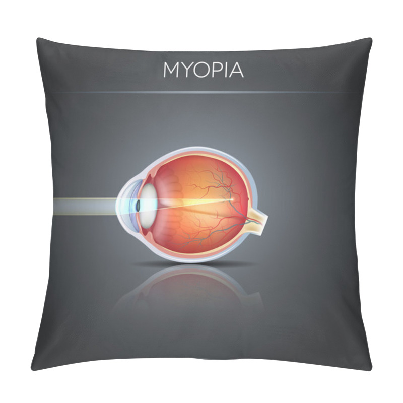 Personality  Human Vision Disorder, Myopia.  Myopia Is Being Shortsighted.  Pillow Covers