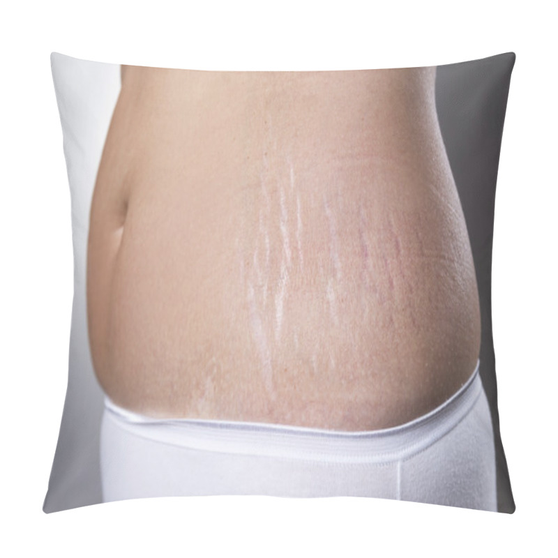 Personality  Female Belly With Pregnancy Stretch Marks Closeup Pillow Covers