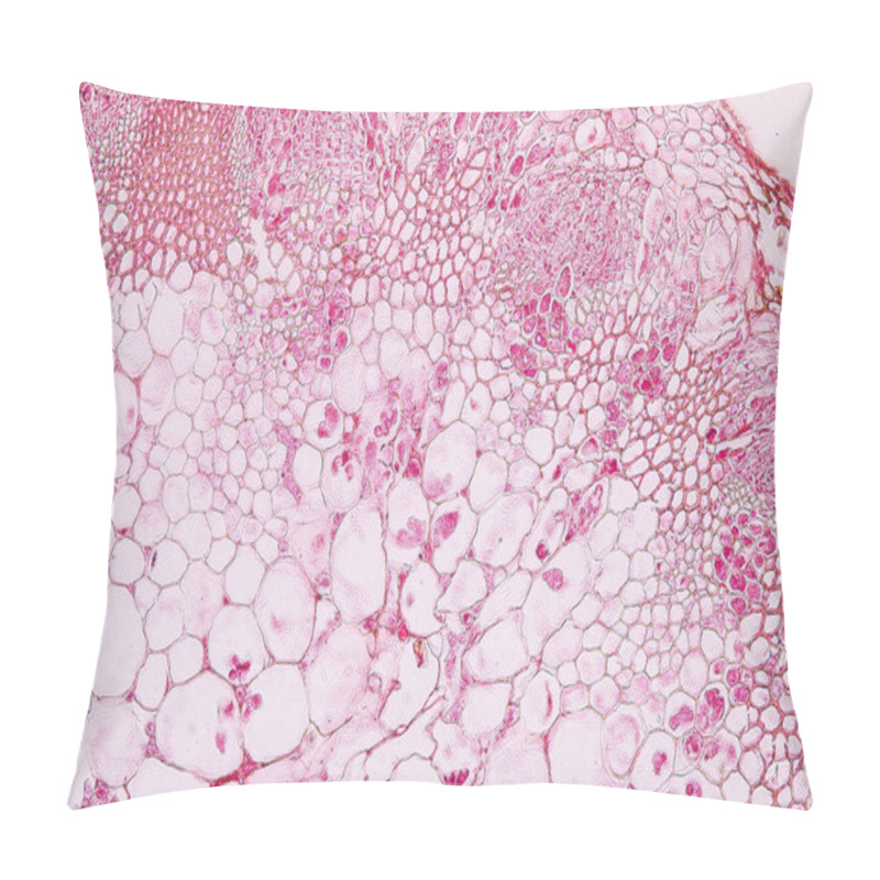 Personality  Zygomycota, Or Zygote Fungi ,Downy Mildew Of Cruzifers Host Tissue With Conidia Living In Decaying Plant On Slide Under The Microscope For Education. Pillow Covers