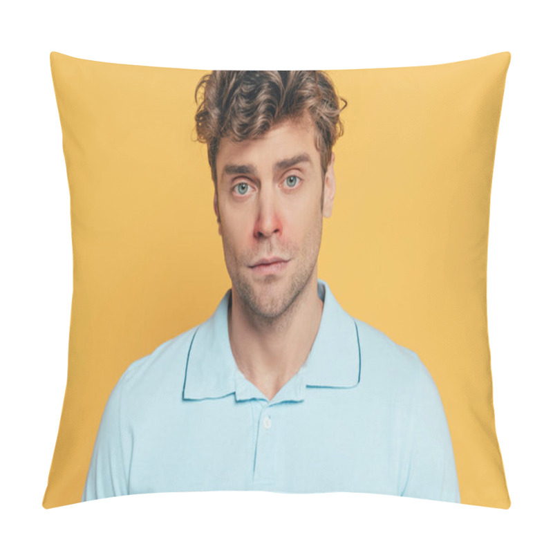 Personality  Portrait Of Sick Man With Redness On Nose Isolated On Yellow  Pillow Covers