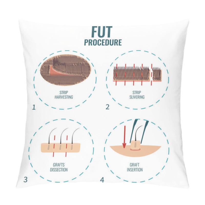 Personality  FUT Hair Loss Treatment Pillow Covers