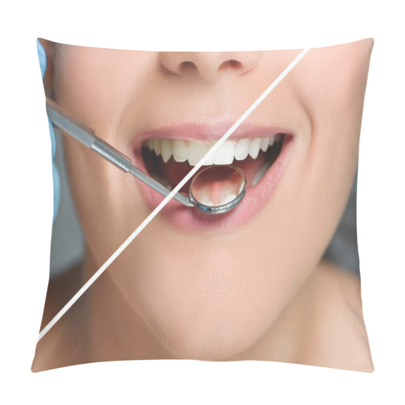 Personality  Partial View Of Dentist With Dental Mirror Checking Womans Teeth, Teeth Whitening Concept Pillow Covers