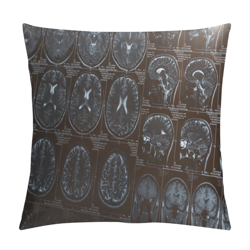 Personality  Magnetic Resonance Imaging Of Brain, Concept Of Alzheimer Disease  Pillow Covers