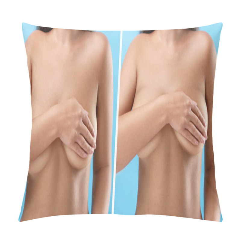 Personality  Collage With Photos Of Woman Before And After Breast-lift Surgery On Light Blue Background, Closeup Pillow Covers