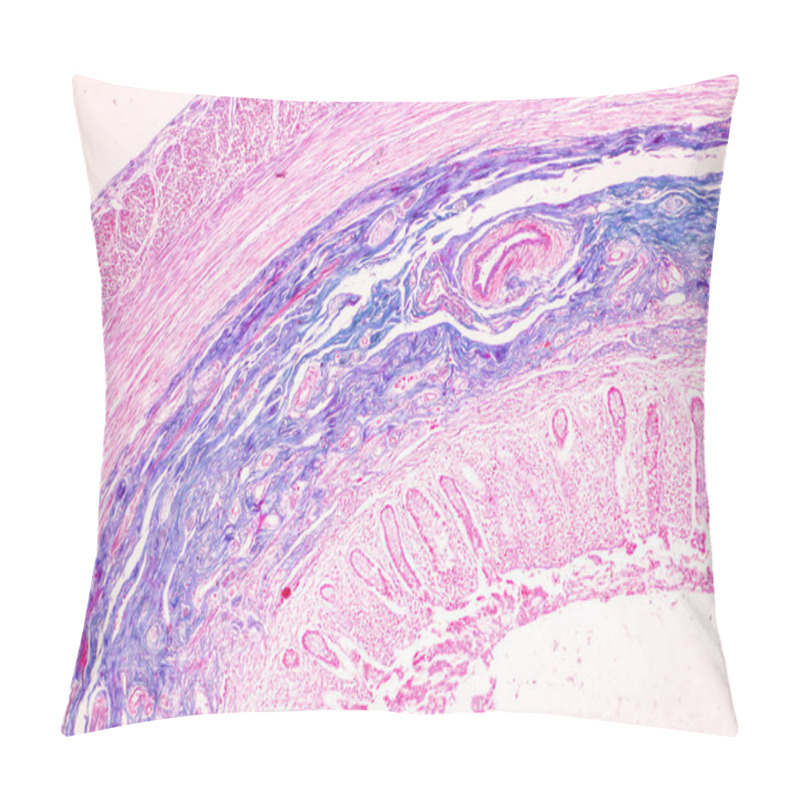 Personality  Tissue Of Small Intestine (Duodenum) And Vermiform Appendix  Human Under The Microscope In Lab. Pillow Covers