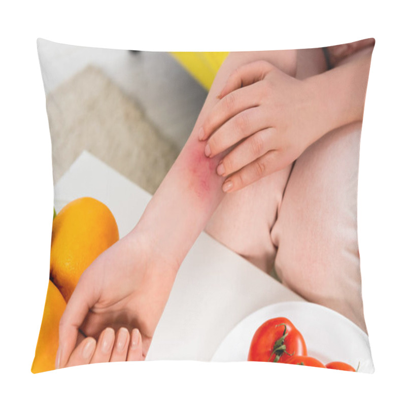 Personality  Cropped View Of Woman With Allergy Scratching Arm Near Tomatoes And Fruits  Pillow Covers