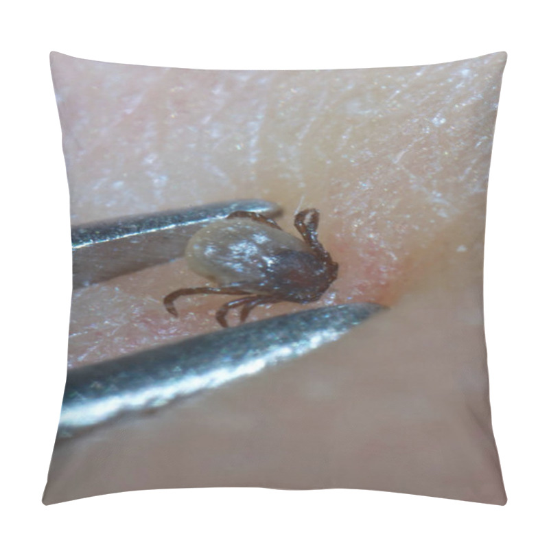 Personality  Super Close Up Of Sucking Tick (Ixodes Ricinus) Removal With Steel Tweezers On Human Skin. Adult Ticks Feed On Large Mammals  For 613 Days, Before Dropping Off.          Pillow Covers