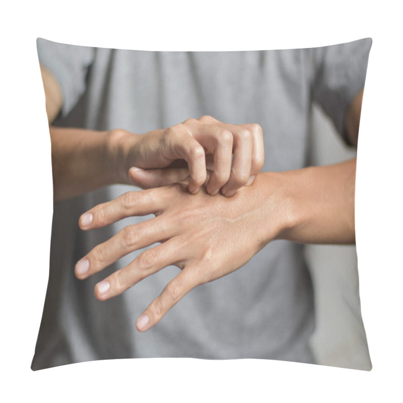 Personality  Asian Young Man Scratching His Hand. Concept Of Itchy Skin Diseases Such As Scabies, Fungal Infection, Eczema, Psoriasis, Rash, Allergy, Etc. Pillow Covers