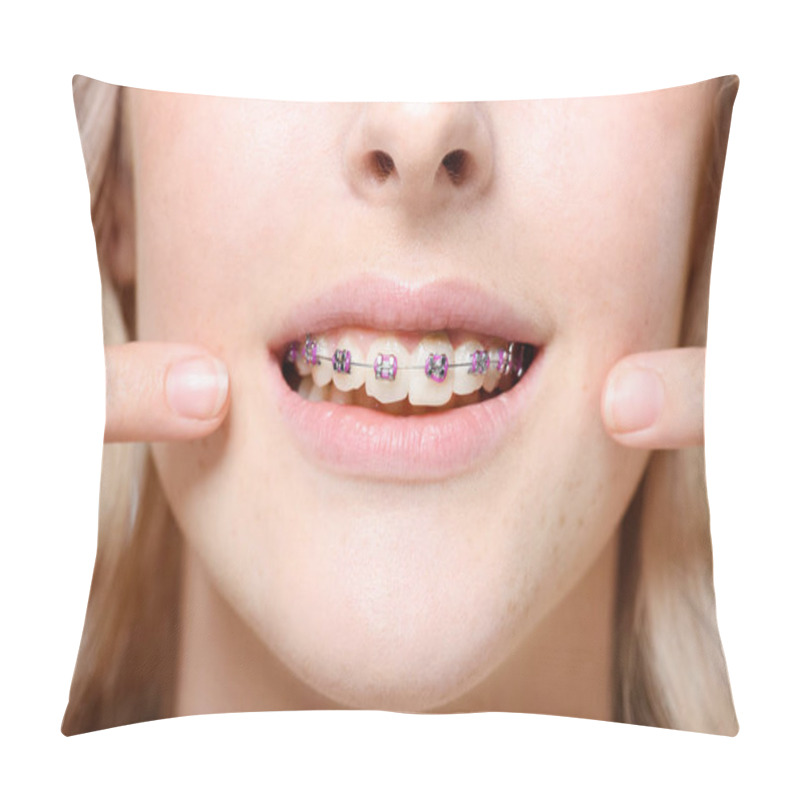 Personality  Braces Pillow Covers