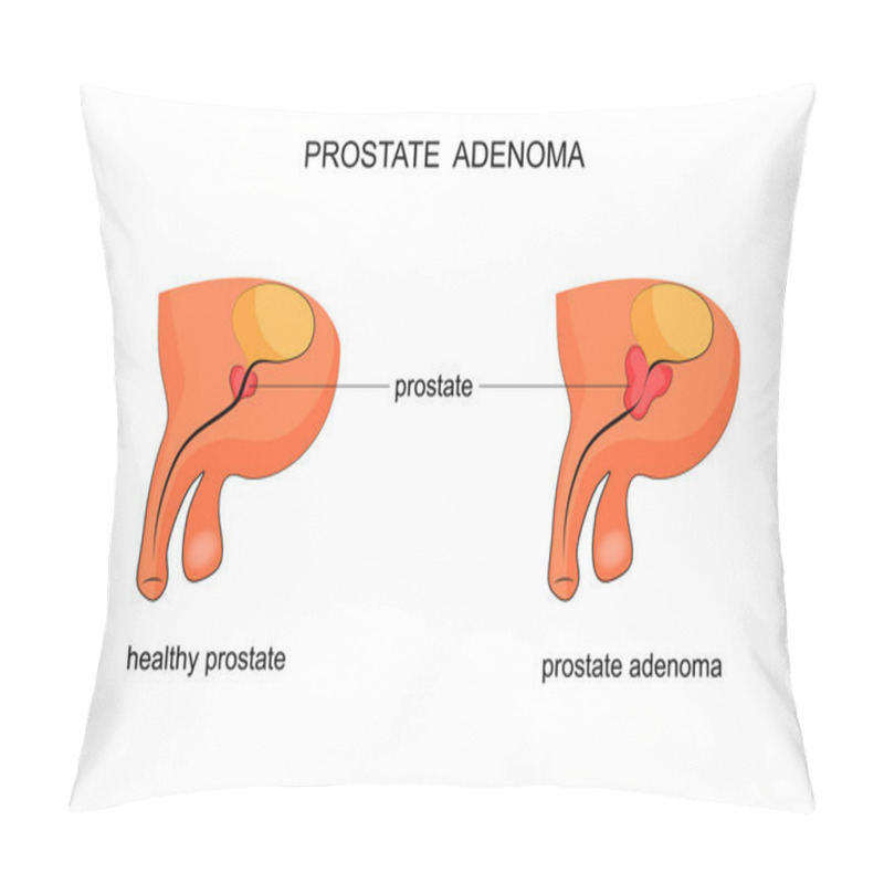 Personality  Healthy Prostate And BPH Pillow Covers