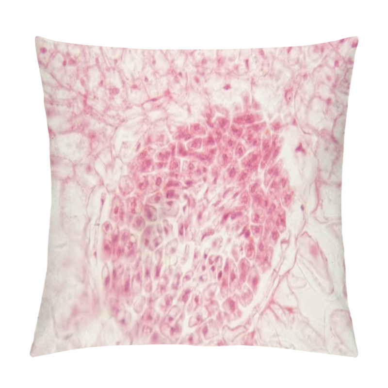 Personality  Root Bacteria Nodules Under The Microscope. Pillow Covers