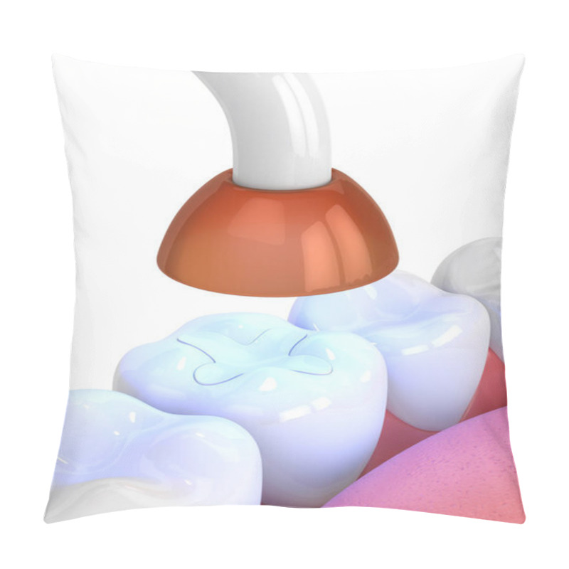 Personality  3d Render Of Jaw With Dental Polymerization Lamp And Light Cured Inlay Filling Over White Background Pillow Covers