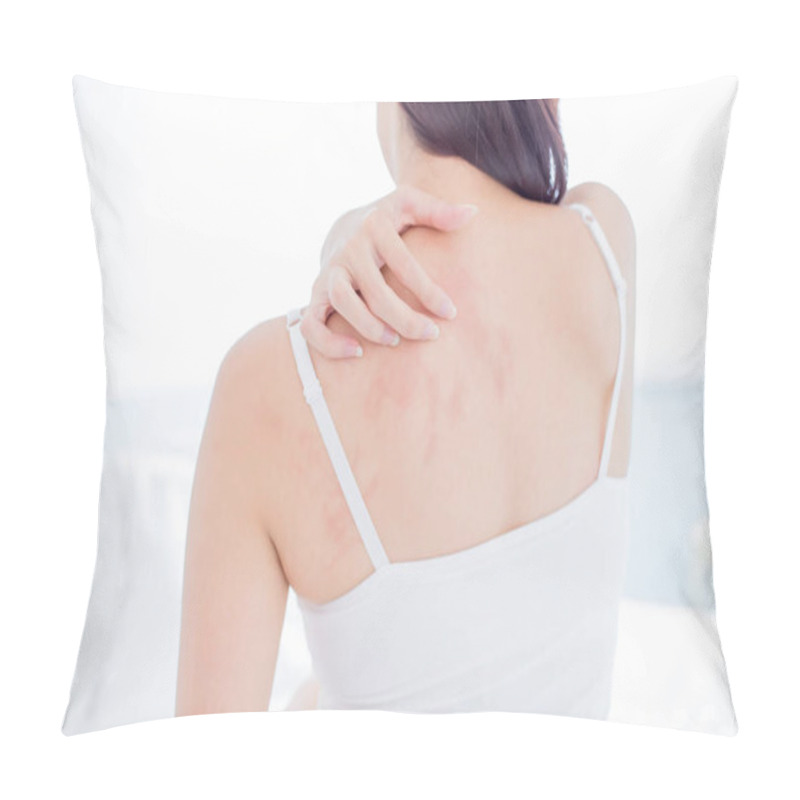 Personality  Woman Scratching Her Shoulder And Neck Because Of Dry Skin At Home Pillow Covers