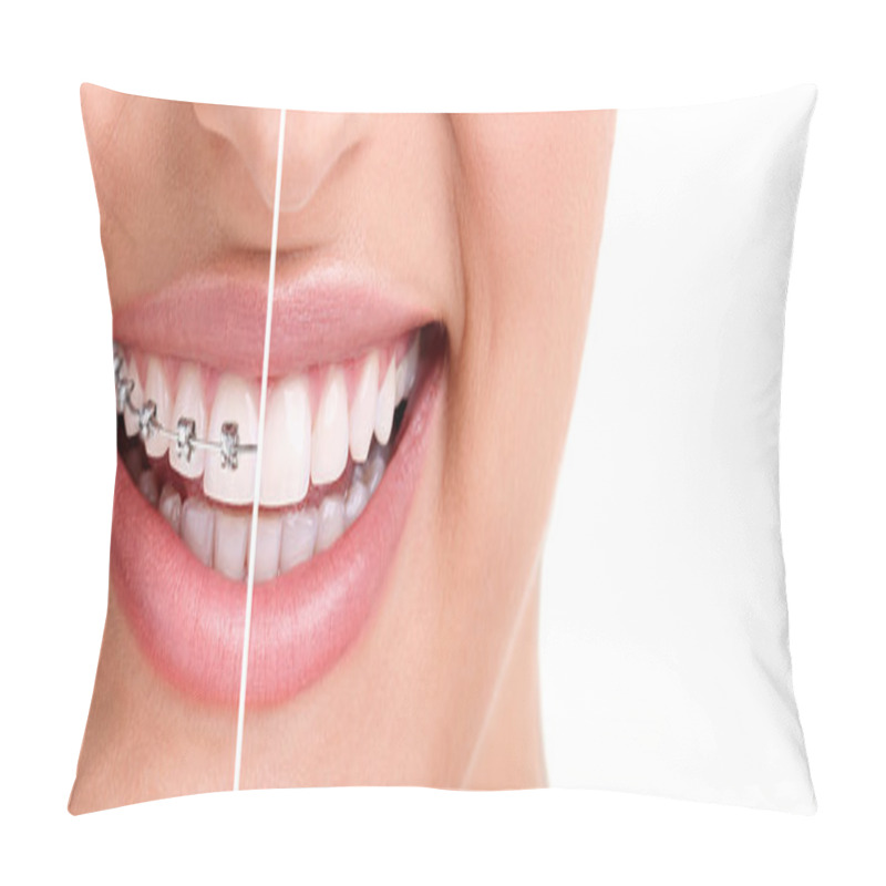 Personality  Healthy Smile With Braces Pillow Covers