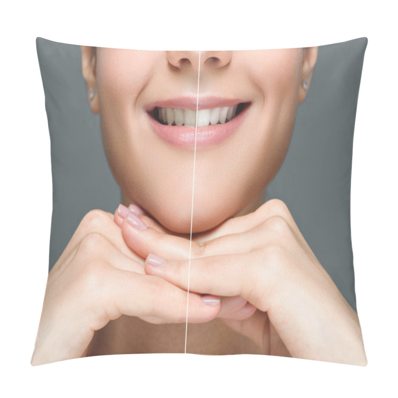 Personality  Partial View Of Smiling Woman Before And After Teeth Whitening Isolated On Grey Pillow Covers