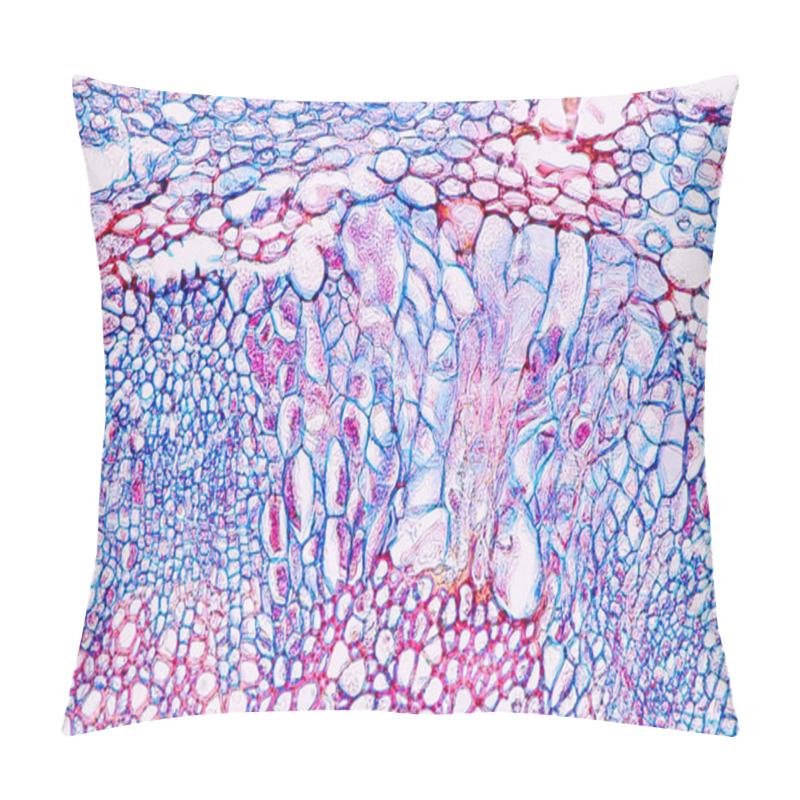 Personality  Zygomycota, Or Zygote Fungi ,Downy Mildew Of Cruzifers Host Tissue With Conidia Living In Decaying Plant On Slide Under The Microscope For Education. Pillow Covers