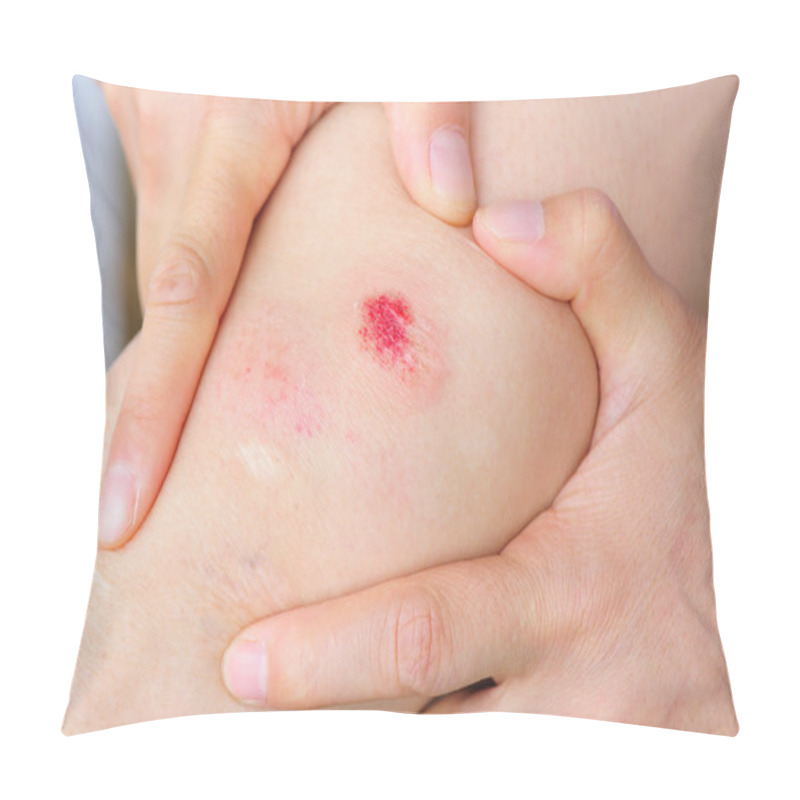 Personality  Injured Knee Pillow Covers