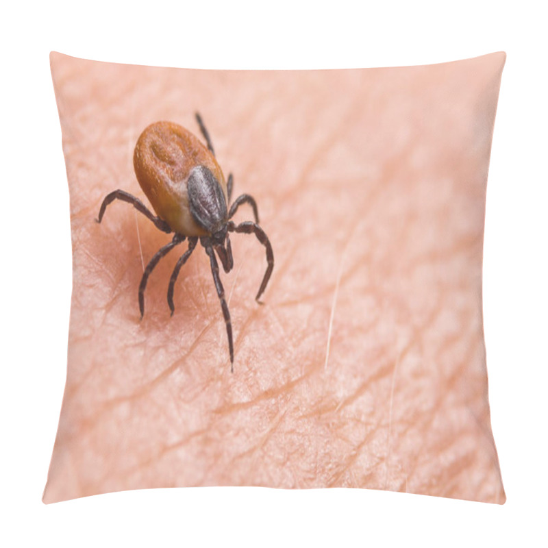 Personality  Infected Female Deer Tick On Hairy Human Skin. Ixodes Ricinus. Parasitic Mite. Acarus Pillow Covers