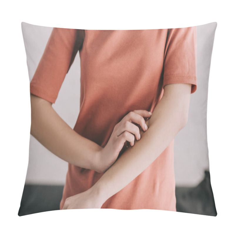 Personality  Cropped View Of Woman Scratching Hand While Having Allergy  Pillow Covers