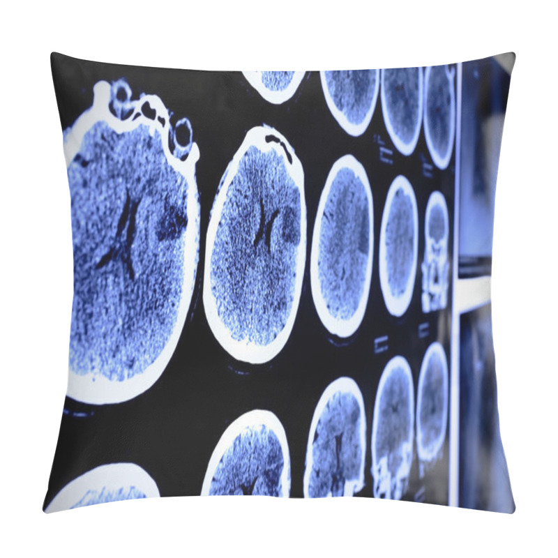 Personality  CT X-ray  Pillow Covers