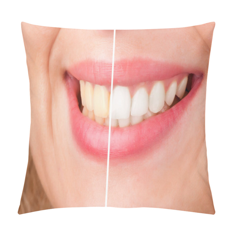 Personality  Dental Whitening Pillow Covers