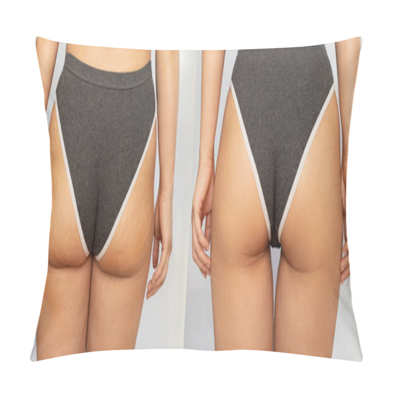 Personality  Close-up Of Female Buttocks With Cellulite Before And After Treatment Isolated On A White Background. Getting Rid Of Excess Weight, Diet, Healthy Nutrition, Training, Sports, Massage, Scrub. Wellness Pillow Covers