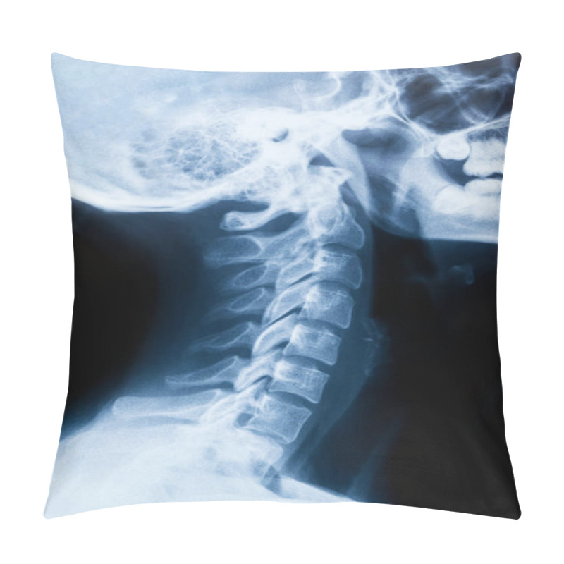 Personality  X-ray Of The Neck And Skull - Side View Pillow Covers