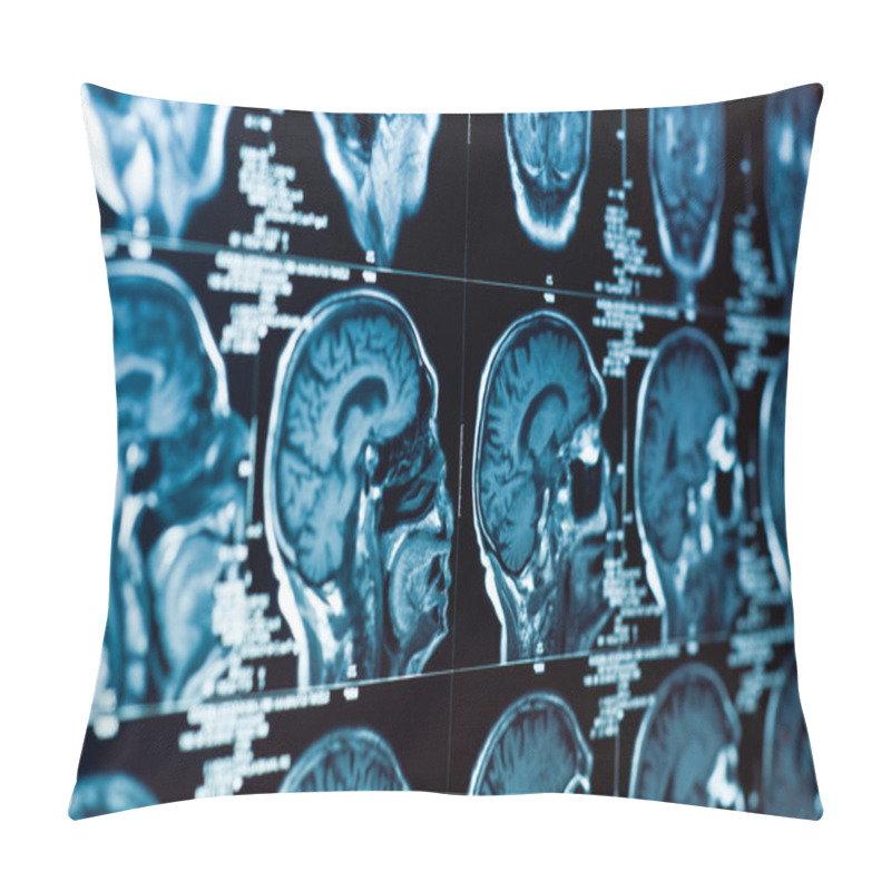 Personality  Closeup Of A CT Scan With Brain And Skull On It Pillow Covers