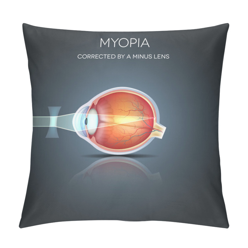 Personality  Myopia Corrected By A Minus Lens Pillow Covers