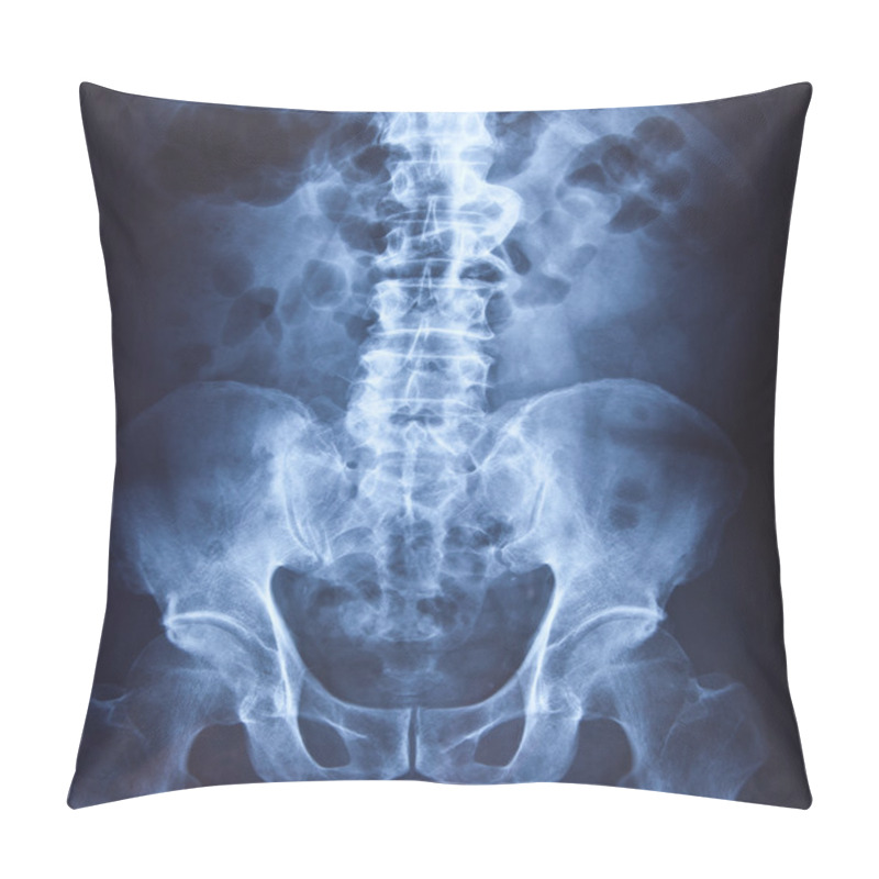 Personality  X-ray Of The Pelvis And Spinal Column Pillow Covers