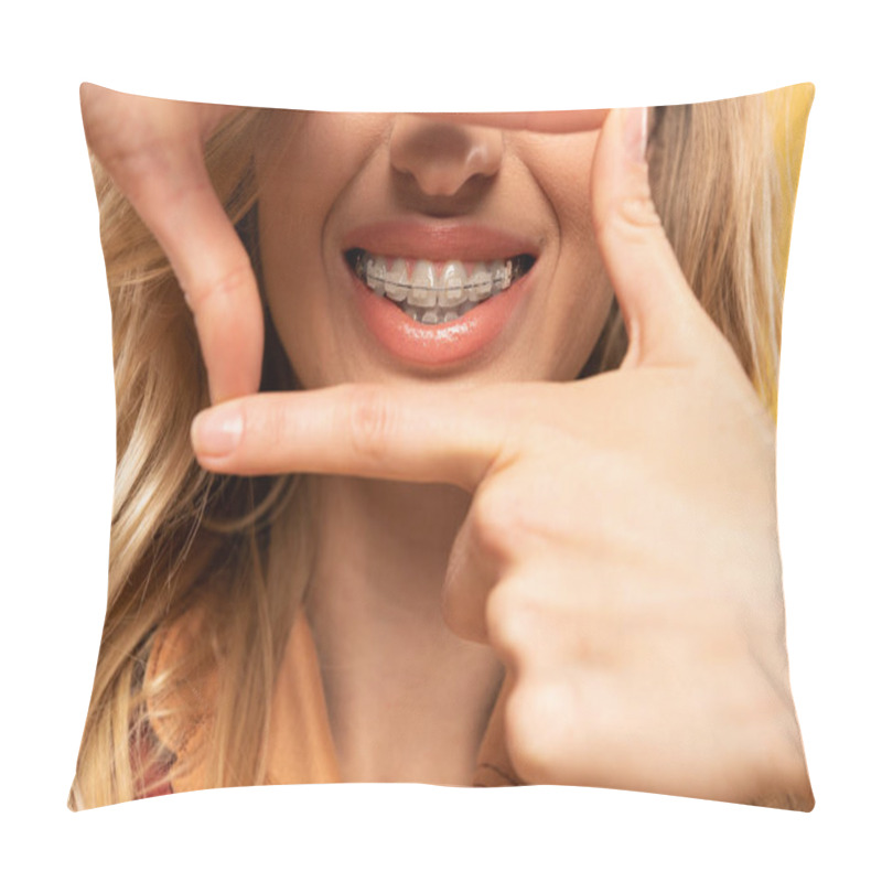 Personality  Cropped View Of Smiling Woman With Dental Braces Isolated On Yellow Pillow Covers