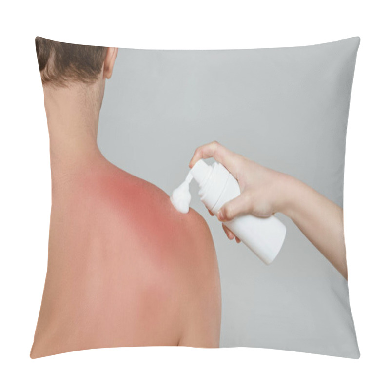 Personality  Cropped View Of Woman Applying Foam On Male Back With Sunburn Isolated On Grey Pillow Covers