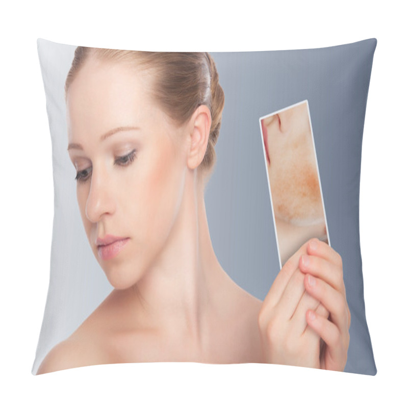 Personality  Concept Skincare . Skin Of Beauty Young Woman With Redness, Skin Pillow Covers