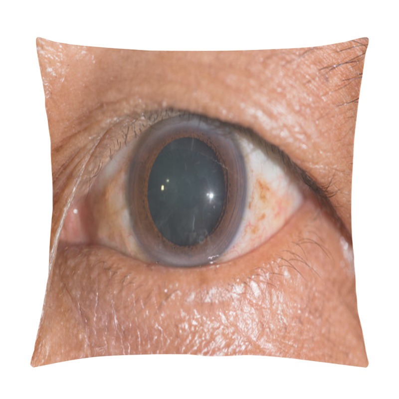 Personality  Eye Exam, Dilated Pupil Pillow Covers