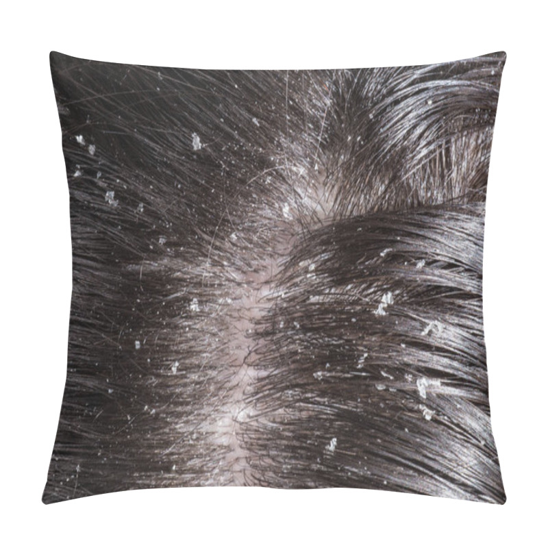 Personality  Dandruff On Her Dark Hair  Pillow Covers