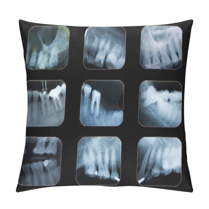 Personality  Dental X-ray Film. Pillow Covers