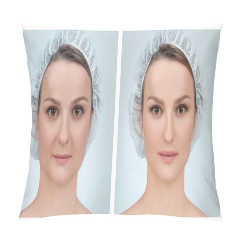 Personality  Portrait Of Female Face, Before And After Plastic Surgery  Pillow Covers