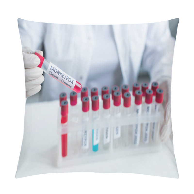 Personality  Cropped View Of Blurred Scientist Holding Test Tube With Monkeypox Lettering In Lab  Pillow Covers