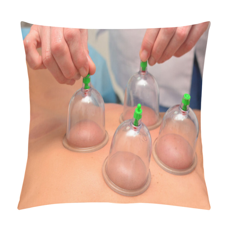 Personality  Cupping Therapy, Woman Doctor Removes Cup From The Patient's Back Pillow Covers