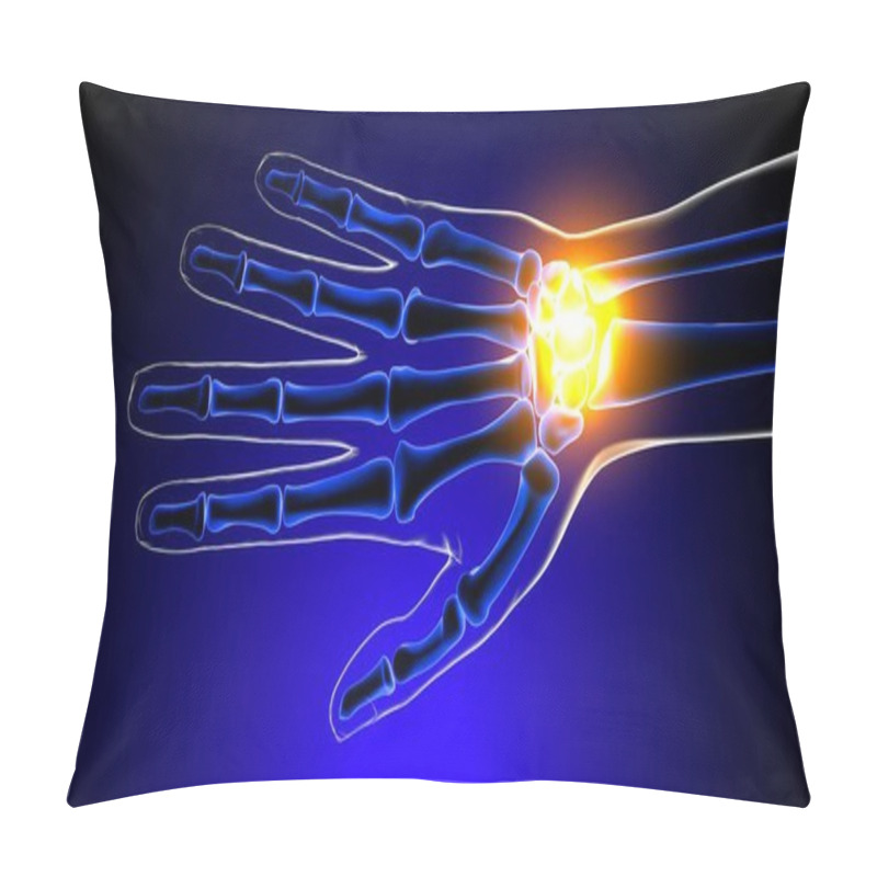 Personality  Wrist Or Carpal Joint Pain Anatomy For Medical Concept 3D Illustration Pillow Covers