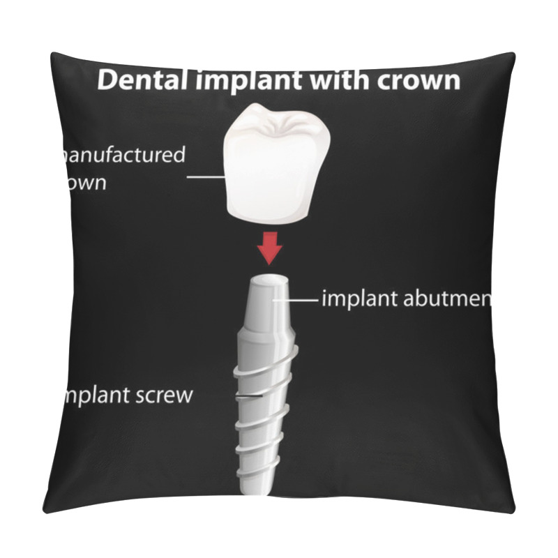 Personality  A Dental Implant With Crown Pillow Covers