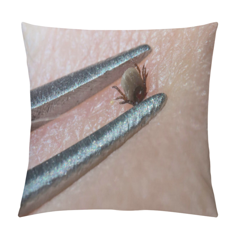 Personality  Super Close Up Of Sucking Tick (Ixodes Ricinus) Removal With Steel Tweezers On Human Skin. Adult Ticks Feed On Large Mammals  For 613 Days, Before Dropping Off.          Pillow Covers