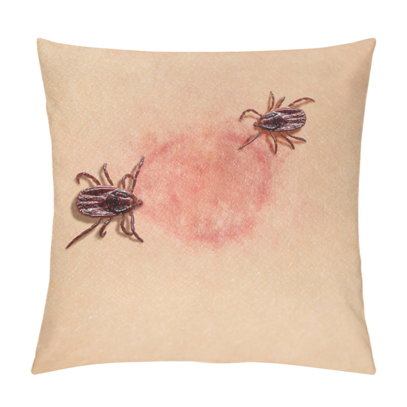 Personality  Redness Of Tick Bite Pillow Covers