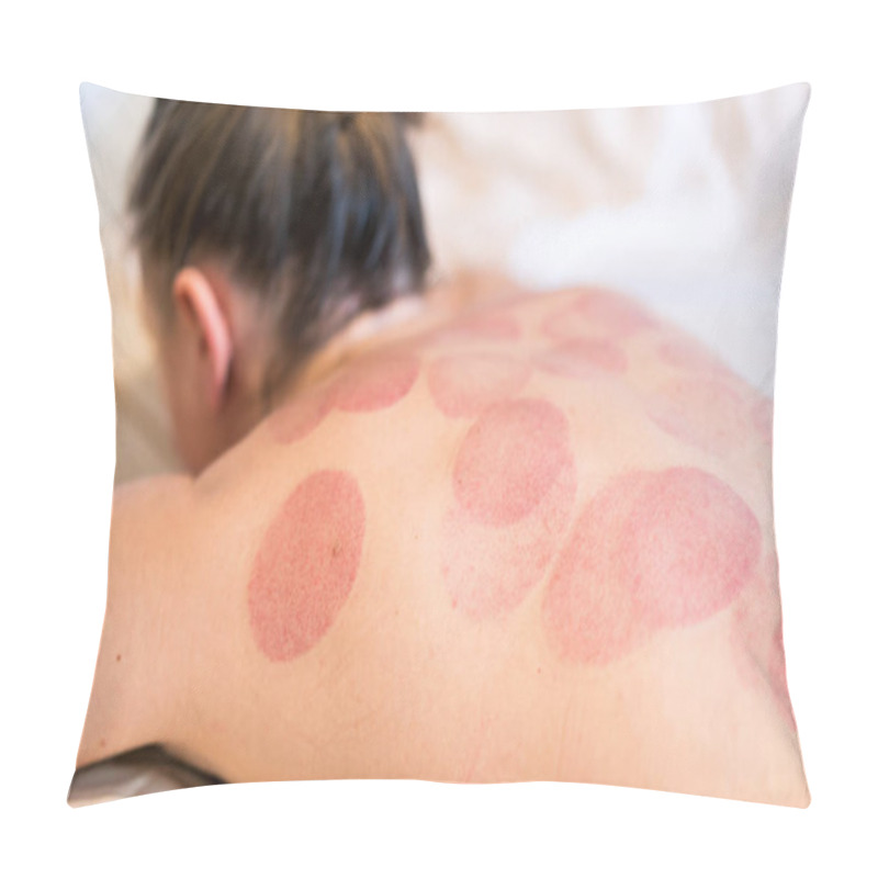 Personality  Woman With Traces Of Vacuum Massage On The Back Close-up Pillow Covers