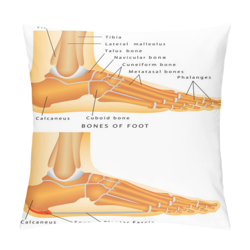 Personality  Heel Spur. Pillow Covers